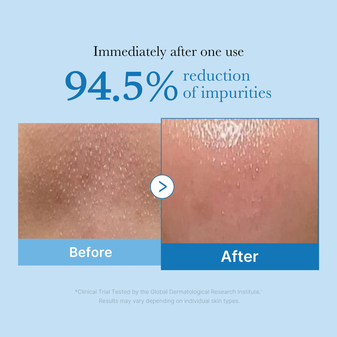 PoreMelt - Dissolve Blackheads, Instantly - 50% OFF