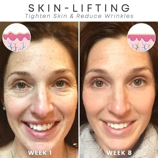The NeuroTox Serum - The Needle-Free Wrinkle Solution - 50% OFF