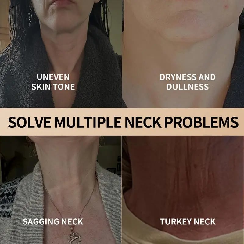 NeckLift+ Firming Neck Cream – Tighten, Lift & Smooth in 28 Days - 1+1 FREE