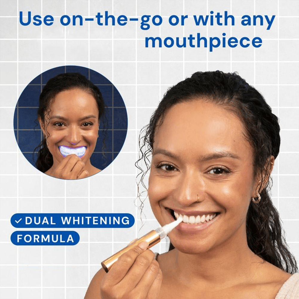 LumiSmile Pen - A Whiter Smile, On-the-Go - 50% OFF