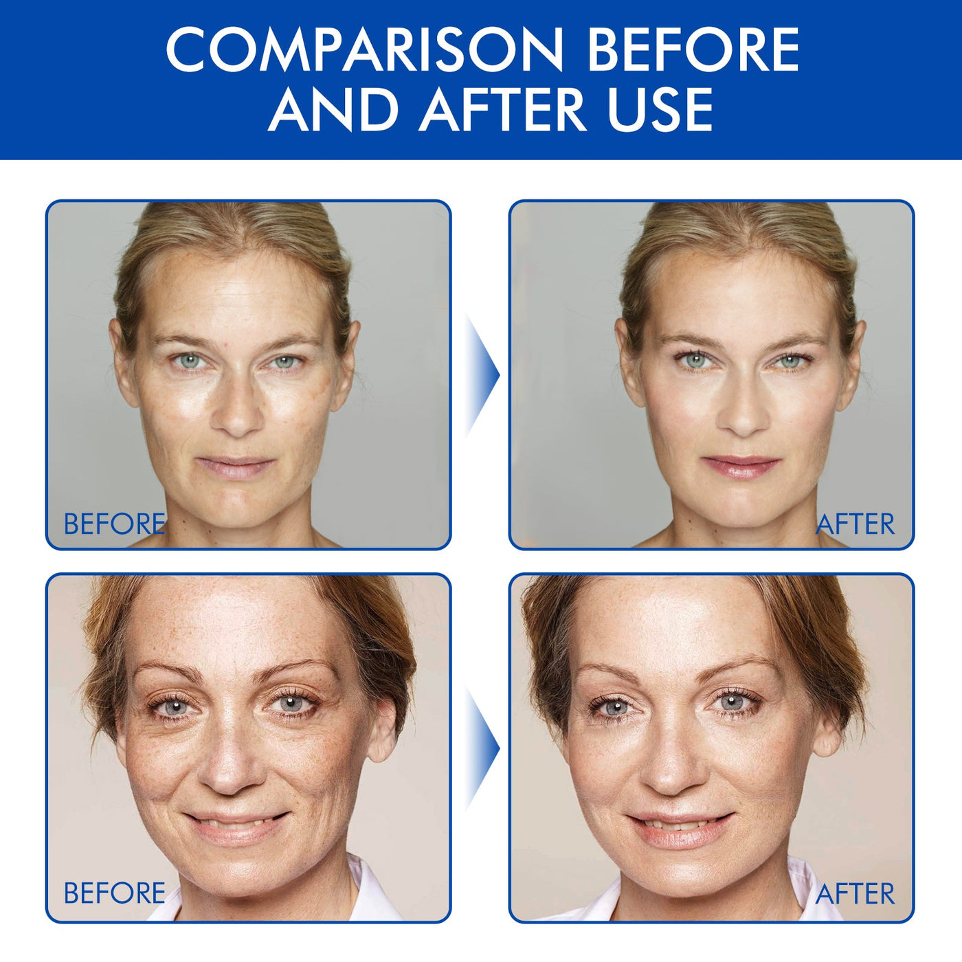The Botox Face Serum - Your Non-Invasive Botox Alternative + 50% OFF