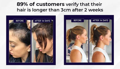 NaturaRevive Hair Spray - 5x Faster Hair Growth + 50% OFF