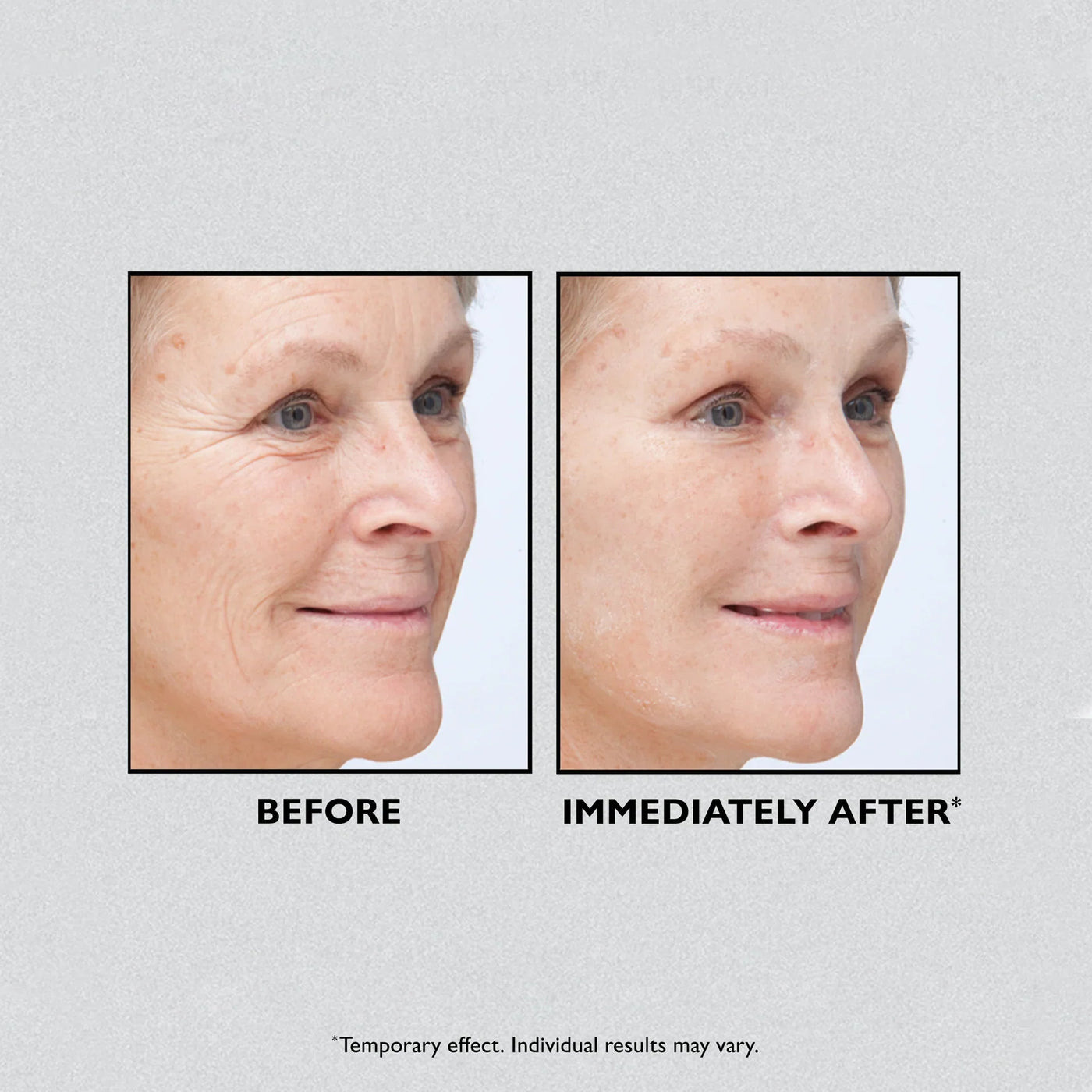 InstaLift Film - Look Years Younger, Instantly - 50% OFF