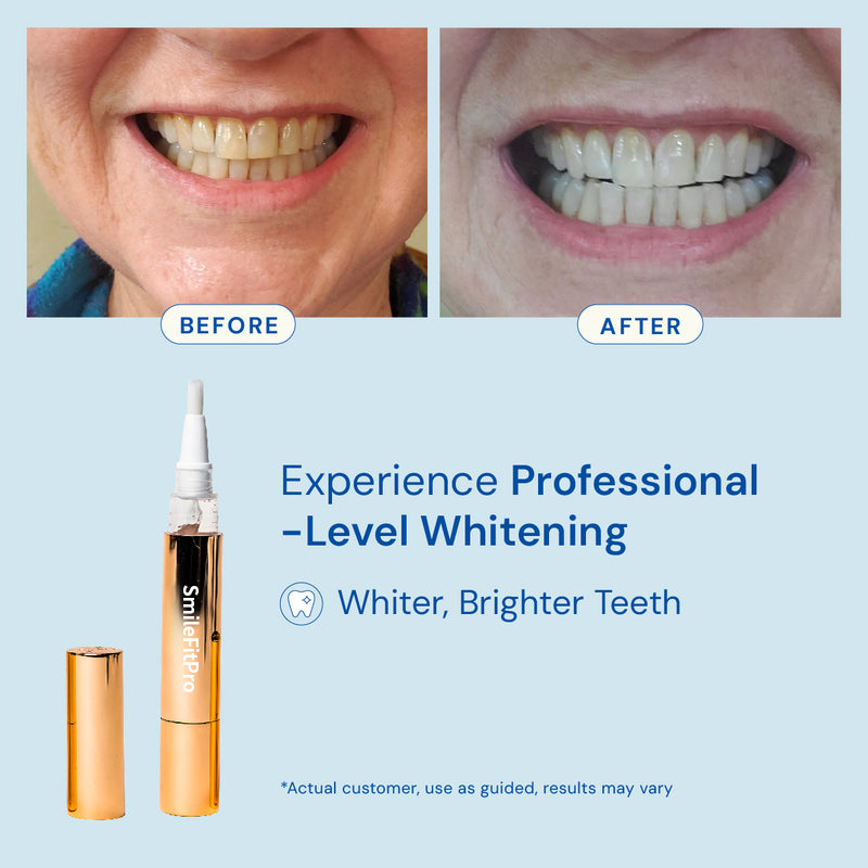 SmileFitPro Whitening Pen - A Whiter Smile, No Sensitivity + 50% OFF