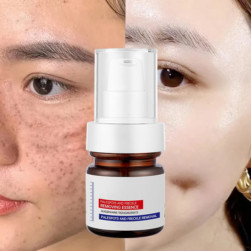 LumaBright - Erase Spots, Reveal Radiance - 50% OFF