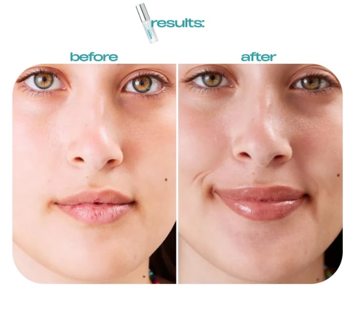 BP Spicule Plumping Lip Shot - Volumizing & Moisturizing Lip Serum - 50% OFF