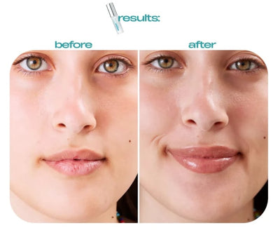 BP Spicule Plumping Lip Shot - Volumizing & Moisturizing Lip Serum - 50% OFF