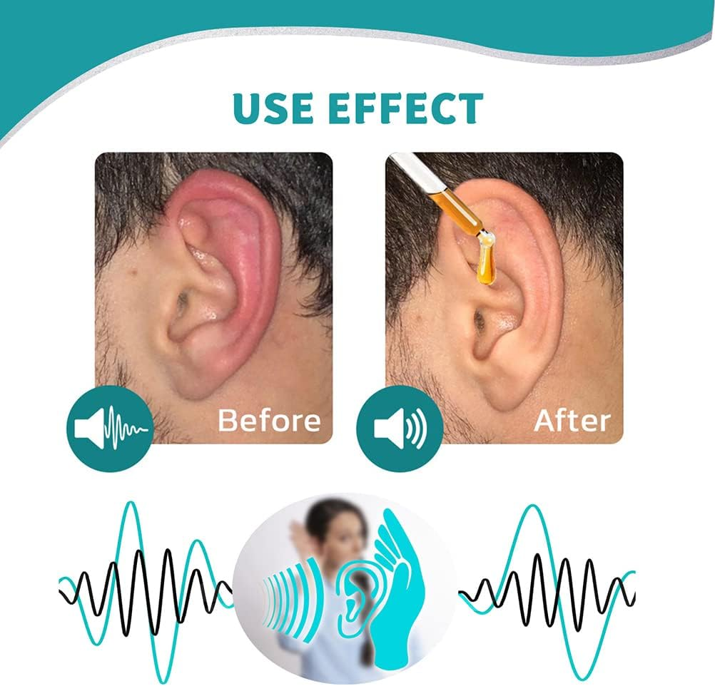 SereneEar Elixir - Quiet the Noise, Soothe the Itch - 50% OFF