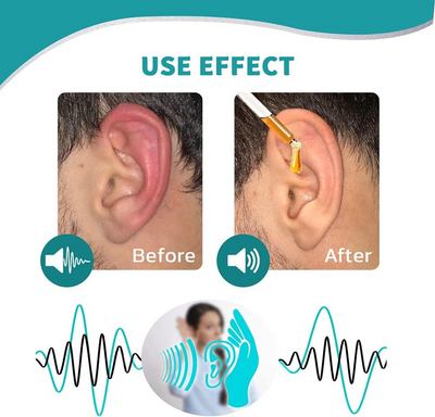 SereneEar Elixir - Quiet the Noise, Soothe the Itch - 50% OFF