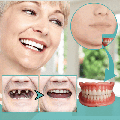 InstaSmile - Your Perfect Smile, in 3 Minutes - 50% OFF