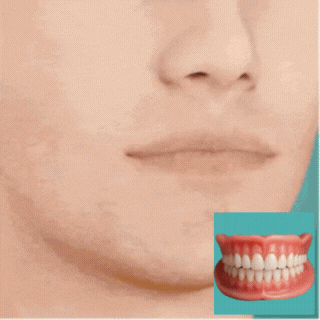 InstaSmile - Your Perfect Smile, in 3 Minutes - 50% OFF
