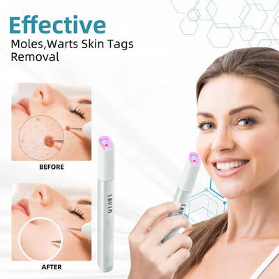 DermaClear Pen - Flawless Skin at Home - 50% OFF