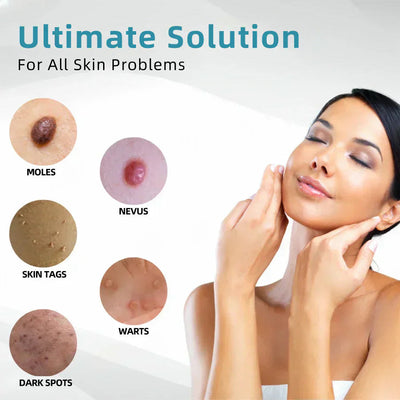 DermaClear Pen - Flawless Skin at Home - 50% OFF