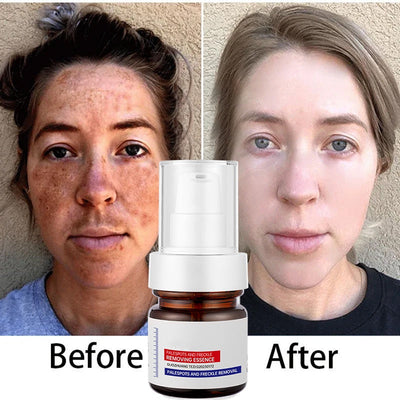 LumaBright - Erase Spots, Reveal Radiance - 50% OFF
