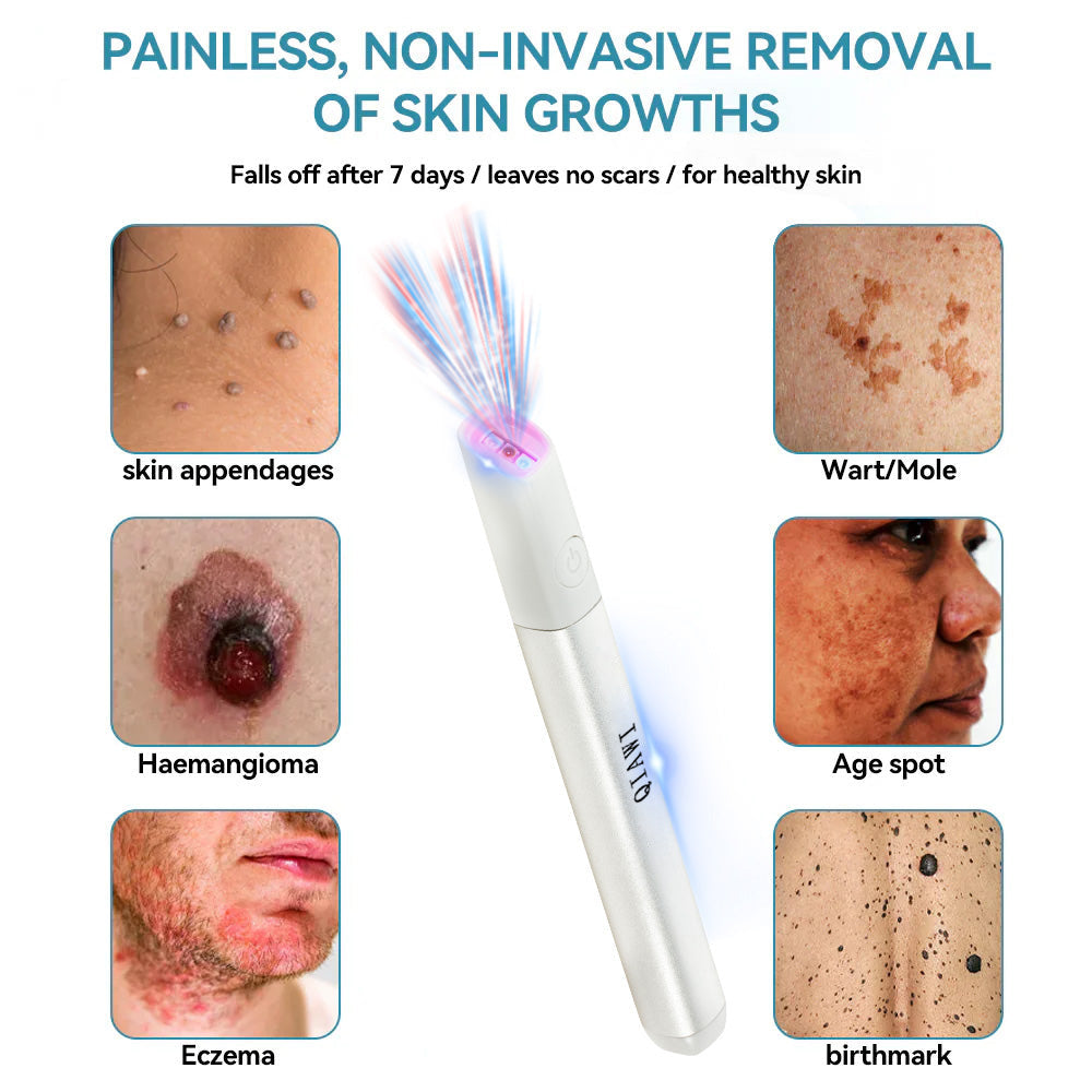 DermaClear Pen - Flawless Skin at Home - 50% OFF