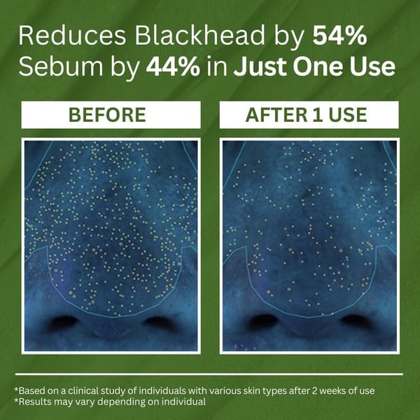 PoreDetox - A Deep-Pore Detox, Instantly - 1+1 FREE