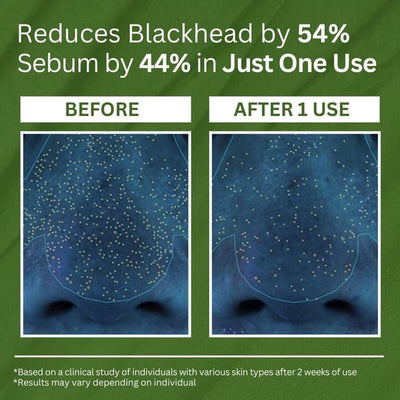 PoreDetox - A Deep-Pore Detox, Instantly - 1+1 FREE