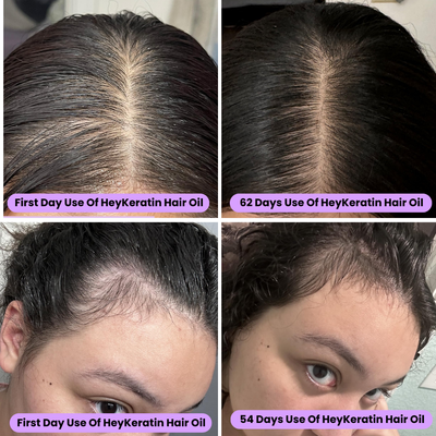 RootRenew Elixir - Reclaim Your Hair's Fullness - 50% OFF