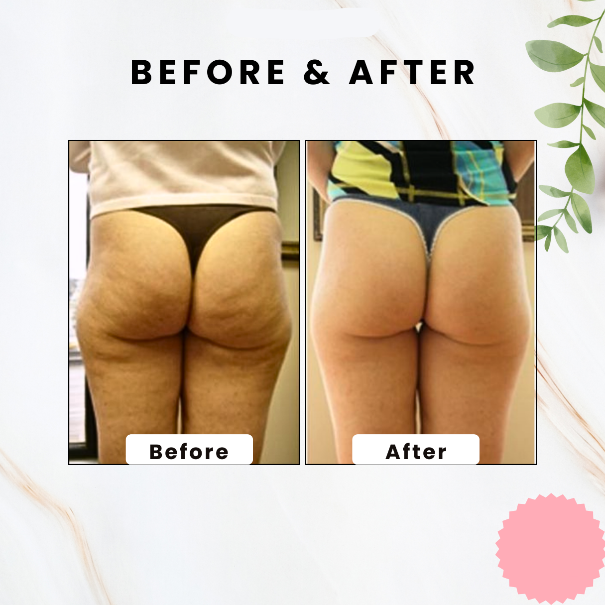 BodySculpt Stone - Visibly Smoother Skin in Weeks - 50% OFF