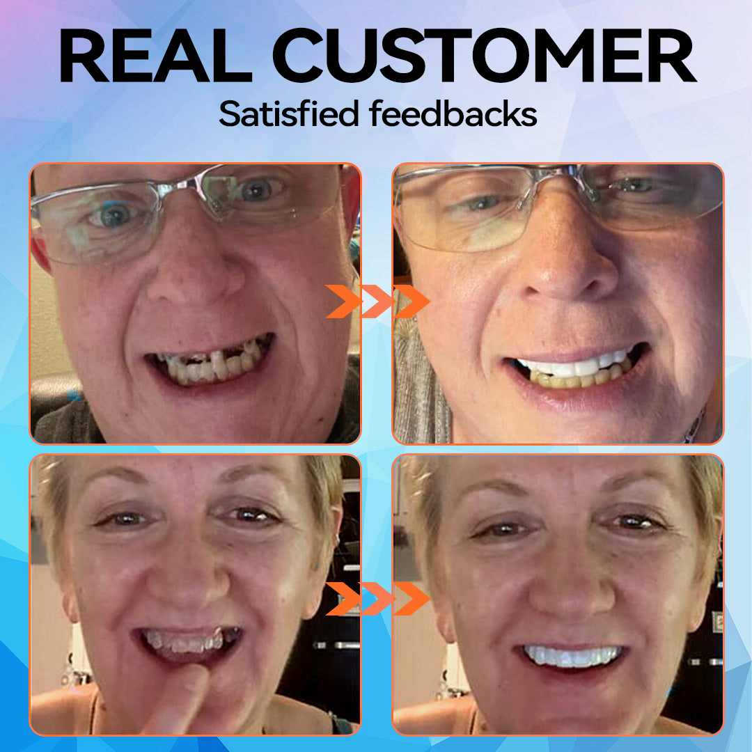 DentaLock Reline Kit - Make Your Loose Dentures Fit Like New - 50% OFF