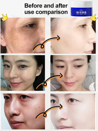The DermaClear Complex - Erase Dark Spots, Restore Clarity - 50% OFF