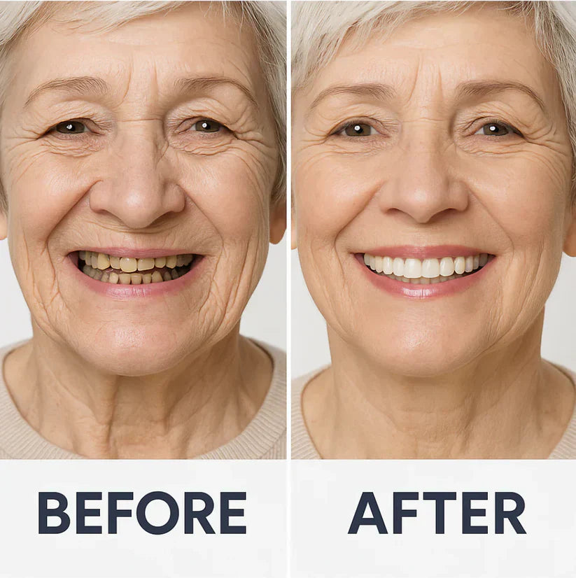 NaturaFit Dentures - The No-Slip, Custom-Fit Smile + 50% OFF