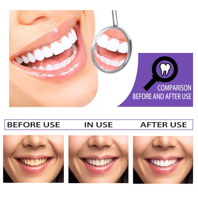 Lumora's Whitening Toothpaste - A Brighter Smile, Gently + 50% OFF