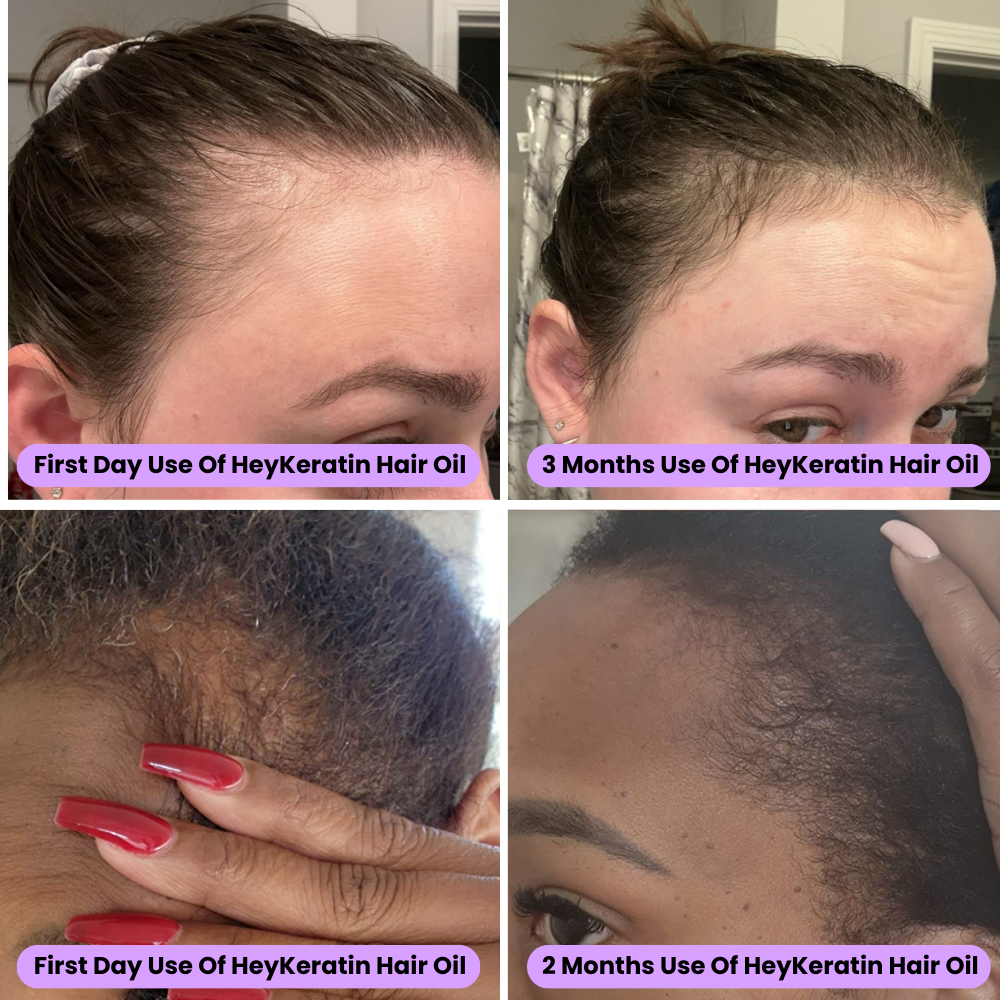 RootRenew Elixir - Reclaim Your Hair's Fullness - 50% OFF