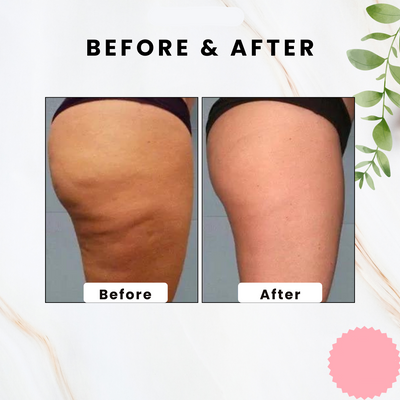 BodySculpt Stone - Visibly Smoother Skin in Weeks - 50% OFF