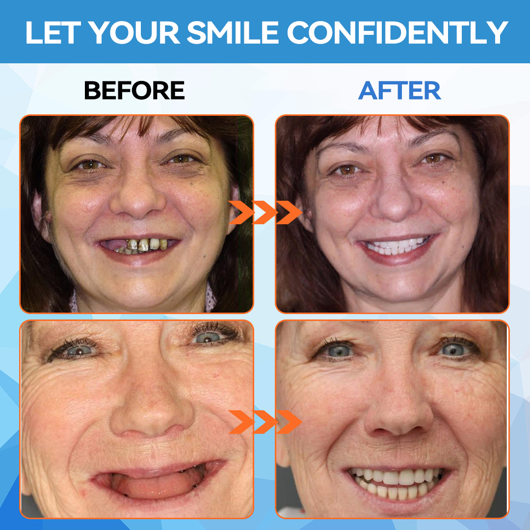 DentaLock Reline Kit - Make Your Loose Dentures Fit Like New - 50% OFF