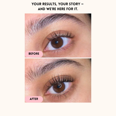 Eyelash Growth Serum - Natural Formula – 1+1 FREE 1