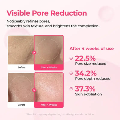 DermaPhase System - Resurface Your Skin, Erase Imperfections - 50% OFF