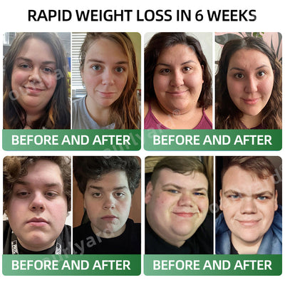 MetaboDrop Control- Effortless Appetite Management & Metabolic Support in Every Drop