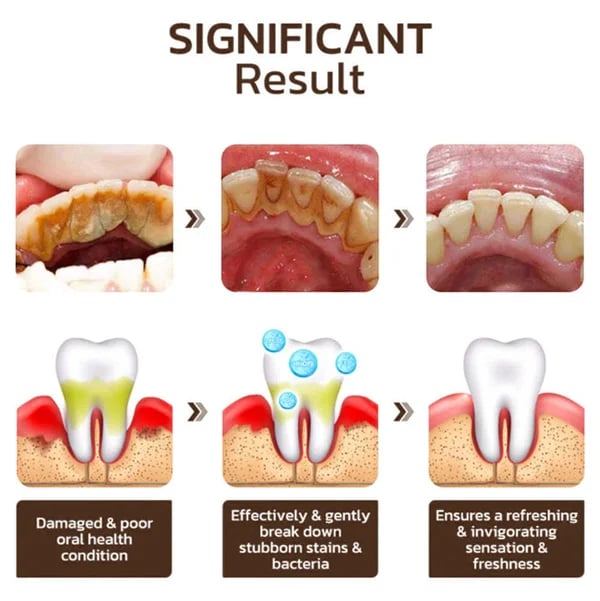 NiacinBright Toothpaste - Reveal your brightest, healthiest, dentist-approved smile