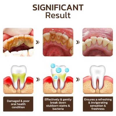 NiacinBright Toothpaste - Reveal your brightest, healthiest, dentist-approved smile