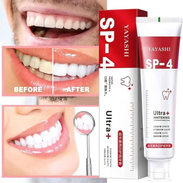 SP-4 Whitening Toothpaste – Gentle Daily Formula Stain Removal - 50% OFF