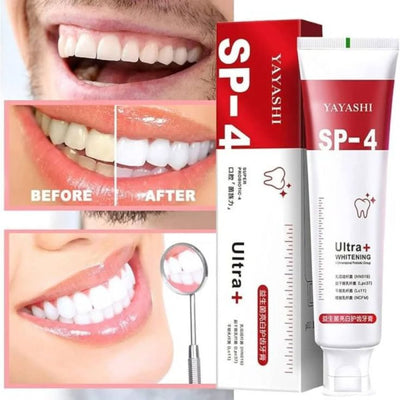 SP-4 Whitening Toothpaste – Gentle Daily Formula Stain Removal - 50% OFF