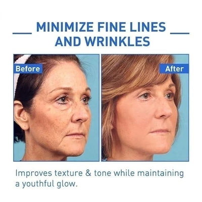The NeuroTox Serum - The Needle-Free Wrinkle Solution - 50% OFF