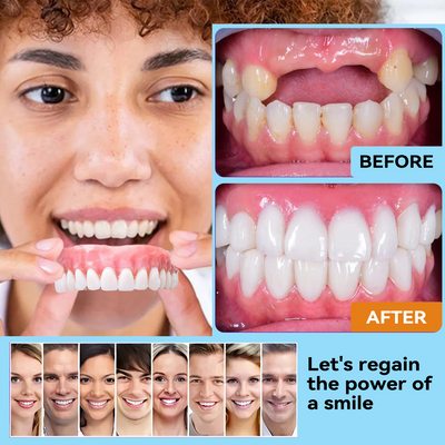 DentaLock Reline Kit - Make Your Loose Dentures Fit Like New - 50% OFF