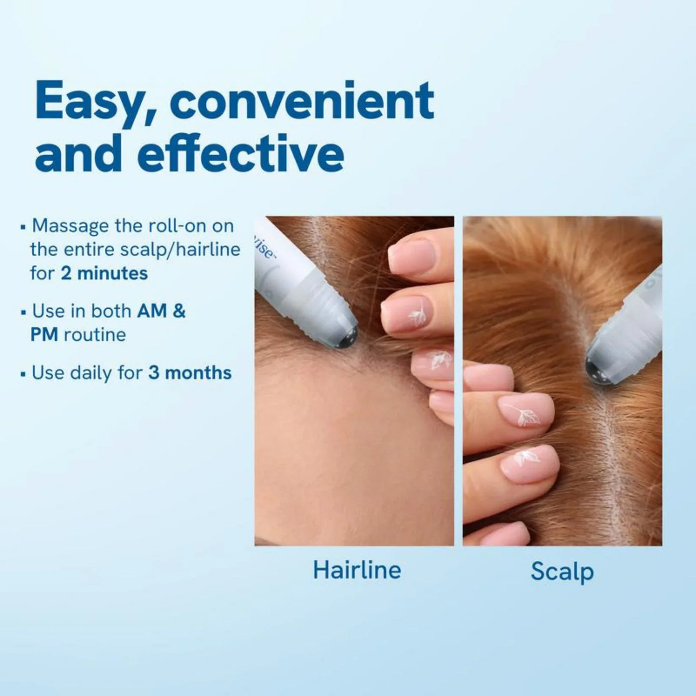 RootRenew Serum - Reawaken Your Hair's Fullness - 50% OFF