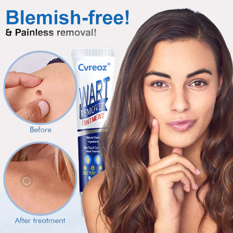 DermaClear Wart Ointment - Your Permanent Skin Solution - 50% OFF