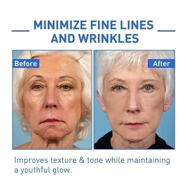 The NeuroTox Serum - The Needle-Free Wrinkle Solution - 50% OFF