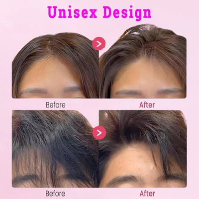 CrownLift Volumizing Hair Clip – 3/6 Teeth High Crown Root Lifter - 1+1 FREE