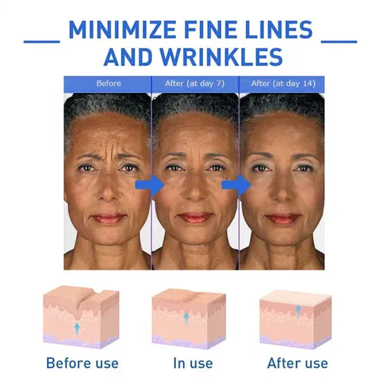 ClearGleam Vitamin B5 Serum – Your Fast-Track to Radiant, Hydrated Skin - 1+1 FREE