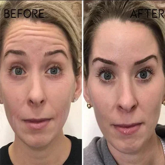 ClearGleam Vitamin B5 Serum – Your Fast-Track to Radiant, Hydrated Skin - 1+1 FREE