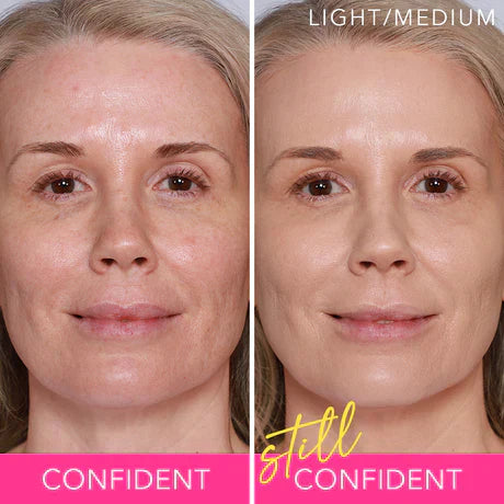 YouthBounce Renew – Rediscover Your Skin’s Youthful Radiance - 1+1 FREE