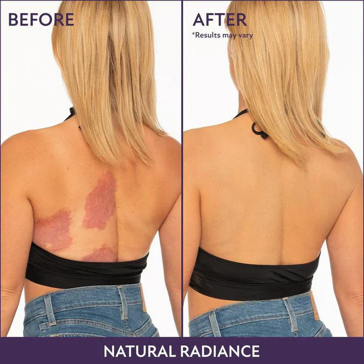 Body Flawless Perfector - Wear Anything With Confidence. + 50% OFF