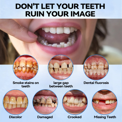 DentaLock Reline Kit - Make Your Loose Dentures Fit Like New - 50% OFF