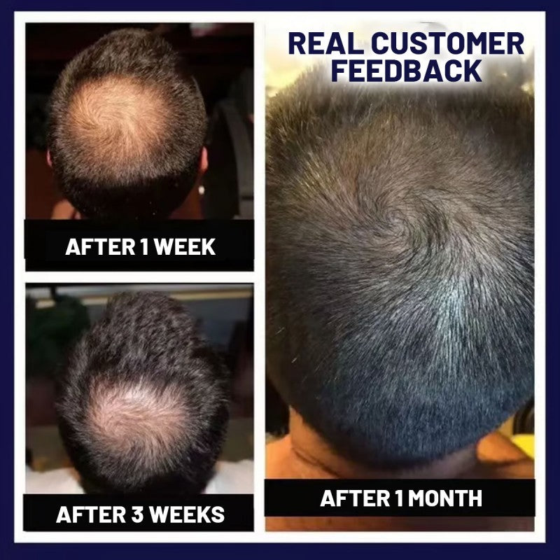 FolliVive - When I Got My Hair Back, I Got Me Back - 50% OFF