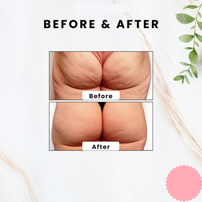 BodySculpt Stone - Visibly Smoother Skin in Weeks - 50% OFF